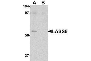 Western blot analysis of LASS5 in SK-N-SH lysate with LASS5 antibody at 1 µg/ml in the (A) absence and (B) presence of blocking peptide. (LASS5 anticorps  (C-Term))