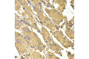 Immunohistochemistry of paraffin-embedded human stomach using PPP2CA antibody.
