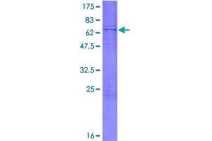 Image no. 1 for UDP-Gal:betaGlcNAc beta 1,4- Galactosyltransferase, Polypeptide 3 (B4GALT3) (AA 1-393) protein (GST tag) (ABIN1346320)
