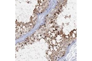 Immunohistochemical staining of human testis with ACRBP polyclonal antibody  shows strong cytoplasmic(acrosomal) positivity in cells of seminiferous ducts.