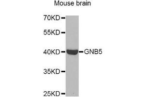 Western Blotting (WB) image for anti-Guanine Nucleotide Binding Protein (G Protein), beta 5 (GNB5) (AA 1-200) antibody (ABIN6220634) (GNB5 anticorps  (AA 1-200))