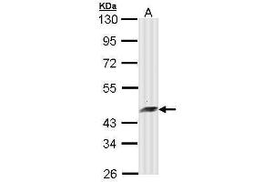 WB Image Sample (30 ug of whole cell lysate) A: Molt-4 , 10% SDS PAGE antibody diluted at 1:10000 (ARFIP2 anticorps)