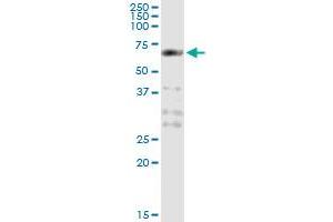 PCTK1 (Human) IP-WB Antibody Pair