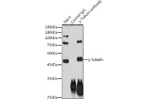 Immunoprecipitation analysis of 300 μg extracts of HeLa cells using 3 μg γ-Tubulin antibody (ABIN7271051). (TUBG1 anticorps)
