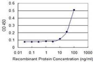anti-RecQ Protein-Like (DNA Helicase Q1-Like) (RECQL) (AA 549-648) antibody