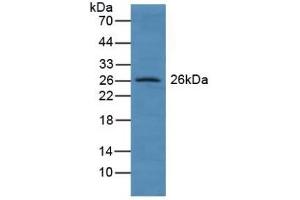 Detection of GSTA4 in Human Lung Tissue using Polyclonal Antibody to Glutathione S Transferase A4 (GSTA4) (GSTA4 anticorps  (AA 3-222))