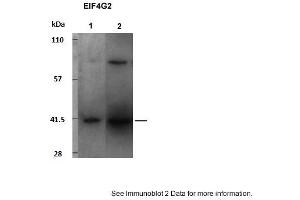 Sample Type: 1. (EIF4G2 anticorps  (C-Term))