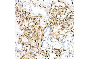 Immunohistochemistry of paraffin-embedded Human kidney using Vimentin antibody (ABIN7271326) at dilution of 1:100 (40x lens).