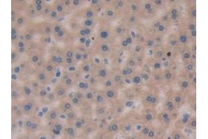 Detection of LMP7 in Rat Liver Tissue using Polyclonal Antibody to Large Multifunctional Peptidase 7 (LMP7)