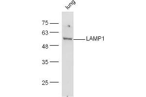 Mouse lung lysates probed with Rabbit Anti-LAMP-1 Polyclonal Antibody, Unconjugated  at 1:500 for 90 min at 37˚C.