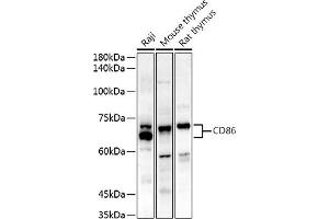 Western blot analysis of extracts of various cell lines, using CD86 antibody (ABIN7266226) at 1:500 dilution. (CD86 anticorps)
