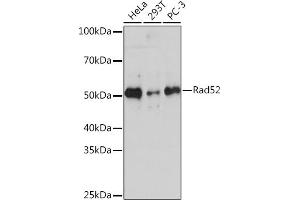Western blot analysis of extracts of various cell lines, using Rad52 Rabbit mAb (ABIN7269828) at 1:1000 dilution.