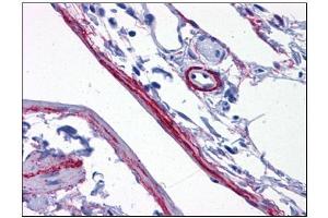 Human Perivascular Processes: Formalin-Fixed, Paraffin-Embedded (FFPE) (SYNPO anticorps  (C-Term))