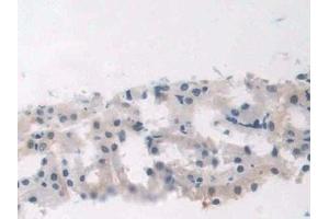 Detection of RAGE in Rat Kidney Tissue using Polyclonal Antibody to Renal Tumor Antigen (RAGE)