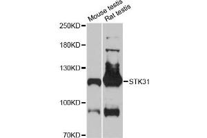 Western blot analysis of extracts of various cell lines, using STK31 antibody (ABIN6293705) at 1:3000 dilution. (STK31 anticorps)