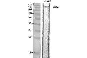 Western Blot (WB) analysis of HepG2 cells using NOS3 Polyclonal Antibody.