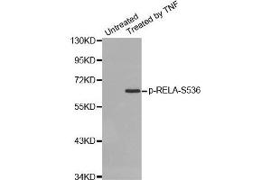 Western blot analysis of extracts from HepG2 cells using Phospho-RELA-S536 antibody. (NF-kB p65 anticorps  (pSer536))