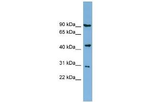 WB Suggested Anti-TUSC4 Antibody Titration:  0. (NPRL2 anticorps  (Middle Region))
