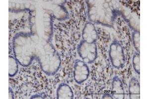 Image no. 2 for anti-Clathrin Interactor 1 (CLINT1) (AA 161-262) antibody (ABIN599495) (CLINT1 anticorps  (AA 161-262))
