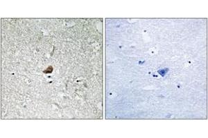 Immunohistochemistry analysis of paraffin-embedded human brain, using IRAK1 (Ab-376) Antibody. (IRAK1 anticorps  (AA 342-391))