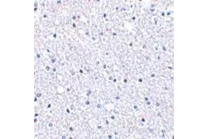 Immunohistochemistry of TIGAR in human brain tissue with this product at 2. (TIGAR anticorps  (Center))