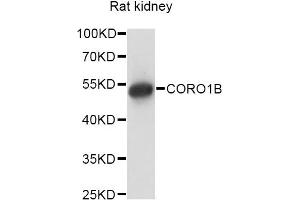Western blot analysis of extracts of rat kidney, using CORO1B antibody. (CORO1B anticorps)