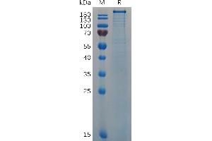 Human VWF (764-2813) Protein, His Tag on SDS-PAGE under reducing condition.