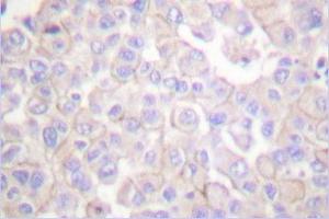 Image no. 1 for anti-Claudin 2 (CLDN2) antibody (ABIN265361) (Claudin 2 anticorps)