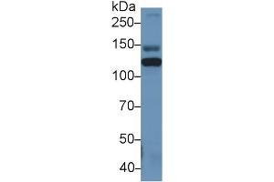 Western Blot; Sample: Rat Serum; Primary Ab: 1µg/ml Rabbit Anti-Human ITIH4 Antibody Second Ab: 0.
