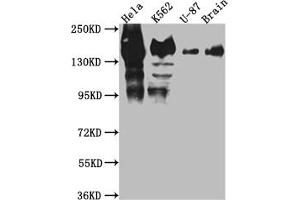 Western Blot Positive WB detected in: Hela whole cell lysate, K562 whole cell lysate, U-87 whole cell lysate, Mouse Brain whole cell lysate All lanes: SF3B1 antibody at 1:1000 Secondary Goat polyclonal to rabbit IgG at 1/50000 dilution Predicted band size: 146, 17 kDa Observed band size: 130 kDa (Recombinant SF3B1 anticorps)