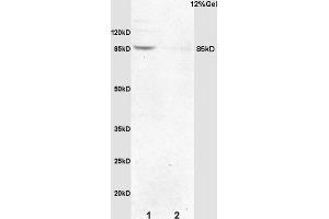 Formalin-fixed and paraffin embedded mouse embryo labeled with Anti-p95 NBS1/Cell cycle regulatory protein p95 Polyclonal Antibody, Unconjugated (ABIN762776) at 1:200 followed by conjugation to the secondary antibody and DAB staining.