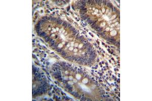 PG Antibody (Center) (ABIN657161 and ABIN2846295) immunohistochemistry analysis in formalin fixed and paraffin embedded human colon tissue followed by peroxidase conjugation of the secondary antibody and DAB staining.