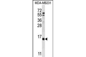 HINT3 Antibody (N-term) (ABIN657020 and ABIN2846199) western blot analysis in MDA-M cell line lysates (35 μg/lane). (HINT3 anticorps  (N-Term))