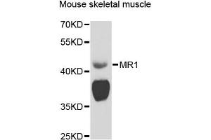 Western blot analysis of extracts of mouse skeletal muscle, using MR1 antibody (ABIN5974481) at 1/1000 dilution. (MR1 anticorps)