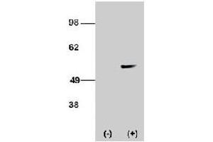 Western blot analysis of STK38L polyclonal antibody  transiently transfected HEK-293 cell line lysate (1 ug/lane). (STK38L anticorps  (C-Term))