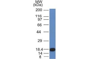 Western Blot Analysis of recombinant fragment of CD117 with CD117 Mouse Monoclonal Antibody (KIT/982). (KIT anticorps  (AA 100-300))