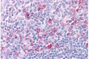 Human Tonsil: Formalin-Fixed, Paraffin-Embedded (FFPE)