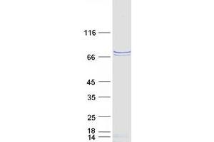 Validation with Western Blot