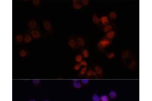 Immunofluorescence analysis of HCT116 cells using KDM7A Polyclonal Antibody at dilution of 1:150. (JHDM1D anticorps)
