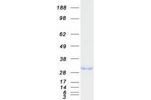Validation with Western Blot
