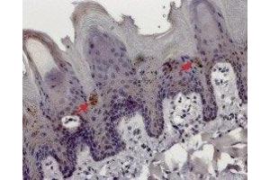 Expression of TRPM5 in rat tongue - Immunohistochemical staining of rat tongue paraffin embedded sections using Anti-TRPM5 Antibody (ABIN7043834, ABIN7044010 and ABIN7044011), (1:100).
