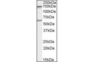 Antibody staining (1 µg/ml) of human Jurkat cells (RIPA buffer, 35 µg total protein per lane). (CARD11 anticorps  (C-Term))