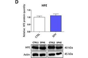 Iron export machinery-related hephaestin (HEPH) and the hemochromatosis gene (HFE) related to systemic iron loading are elevated at the mRNA level but not on the protein level in tumor-initiating cells (TICs)Expression of the HEPH gene at the mRNA level in breast non-malignant cell line MCF10A, in TICs derived from breast cancer cell lines MCF-7, BT-474, T-47D and ZR-75-30 as well as from prostate cancer cell lines DU-145 and LNCaP has been determined (A) together with protein levels in the MCF-7 cell line (CTRL) and MCF-7 derived spheres (SPH) (B). (HFE anticorps  (AA 262-348))