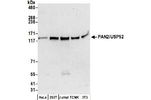 Western Blotting (WB) image for anti-PAN2 Poly(A) Specific Ribonuclease Subunit Homolog (PAN2) (AA 1-50) antibody (ABIN7450538)