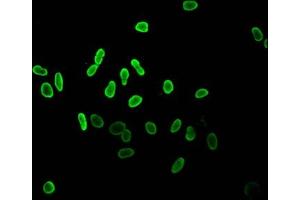 Immunofluorescent analysis of Hela cells (sodium butyrate, 30 mM, 4h) using ABIN7139178 at dilution of 1:100 and Alexa Fluor 488-congugated AffiniPure Goat Anti-Rabbit IgG(H+L)
