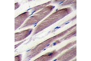 IHC analysis of FFPE human skeletal muscle tissue stained with LATS2 antibody