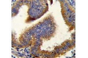 Cyclin B1 antibody immunohistochemistry analysis in formalin fixed and paraffin embedded human uterus tissue.