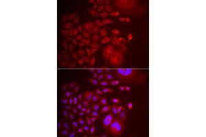 Immunofluorescence analysis of U2OS cell using TRAPPC10 antibody. (TRAPPC10 anticorps)