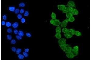IF analysis of Ikaros using anti-Ikaros2 antibody (ABIN3043860). (IKZF1 anticorps  (C-Term))