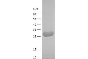 Western Blotting (WB) image for Glutamate-Cysteine Ligase, Modifier Subunit (GCLM) (AA 1-274) protein (His tag) (ABIN7122805)
